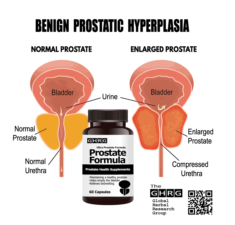 Prostate Formula